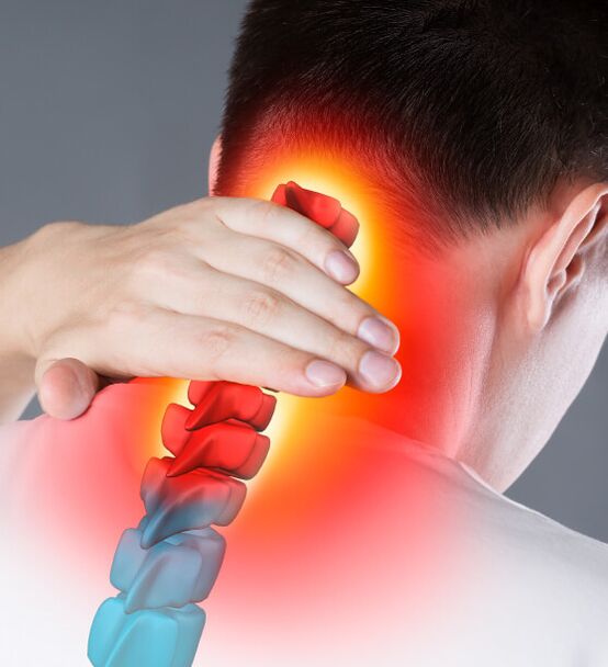 Síntomas de osteocondrosis cervical