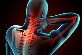 Osteocondrosis cervical