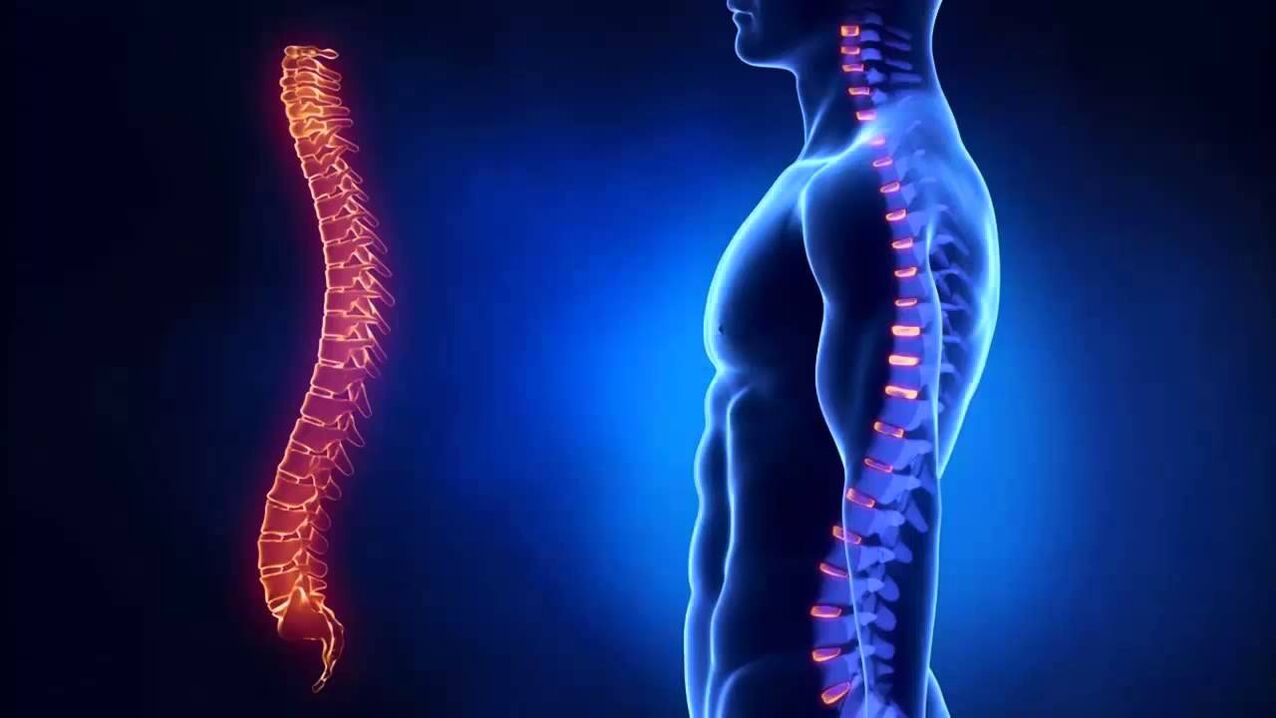 La osteocondrosis se clasifica según las partes de la columna en las que se desarrolla la enfermedad.