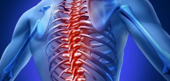 osteocondrosis de la columna torácica